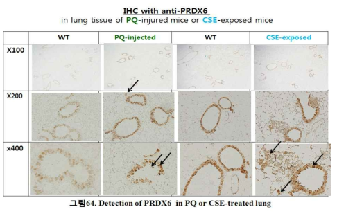 Detection of PRDX6 in PQ or CSE-treated lung. 폐조직에서 PRDX6발현양 확인을 의해 PQ과 CSE마우스 모델을 IHC수행함. 화살표는 apoptosis가 일어나 세포 표시함