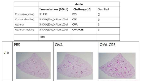 OVA-induced asthma smoking mouse model 의 확립. OVA를 먼저 injcetion한후, smoking을 통해 감작을 해서 ova-smoking model을 만든 후,H&E stain을 통해 확인