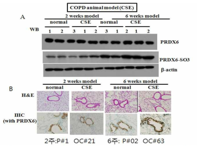 COPD mouse model의 2주와 6주차에서 PRDX6의 과산화 비교. (A) 마우스에 CSE를 2주와 6주를 expose시킨 후 western blotting으로 PRDX6발현양과 과산화정도 확인 (B) H&E stain을 통해 injury damage정도를 확인하고, anti-PRDX6를 이용한 IHC를 수행해서 조직에서 PRDX6발현양 확인
