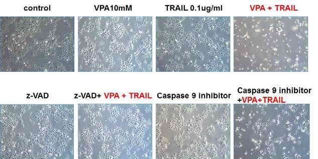 두경부암 세포주 HN3에서 VPA와 TRAIL 병합 처리 하기전 z-VAD (caspase 3, 6, 7 inhibitor)와 caspase 9 inhibitor를 전처리 하여 세포사멸이 감소됨을 광학현미경 사진으로 보여줌