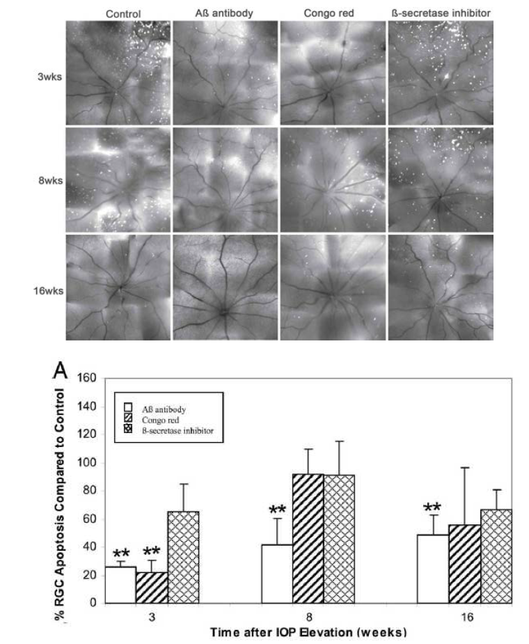 안압상승모델에서의 여러 아밀로이드베타 작용 억제적 주입 후 망막신경절세포의 생존 여부를 비교한 예시 및 정량 그래프