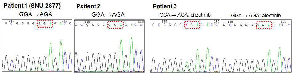 Alectinib 투여 전, 후 환자의 ALK 변이의 변화 확인. Sanger sequencing을 이용하여 ALK Exon 21의 G1202R 변이의 변화 비교