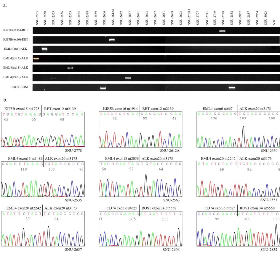 PCR을 이용한 Fusion gene확인 및 Sanger sequencing을 통한 확인
