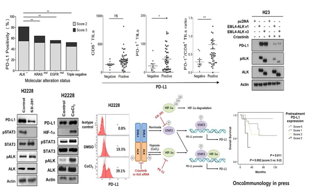 EML4-ALK enhances PD-L1 expression in pulmonary adenocarcinoma via hypoxia-inducible factor (HIF)-1α and STAT3