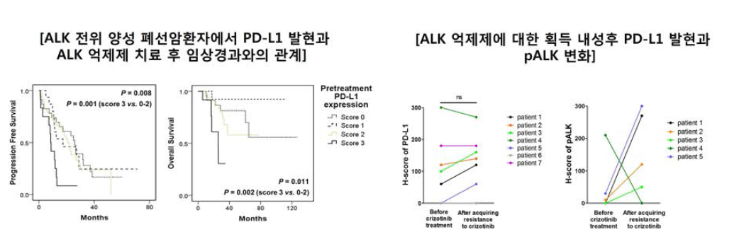ALK 억제제치료후 임상경과와 PD-L1발현의 관계 및 내성획득 후 PD-L1 발현과 pALK 변화