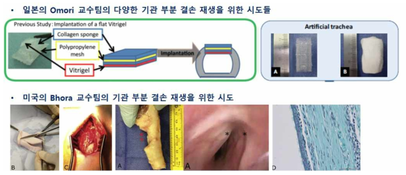 다양한 조직공학용 지지체를 이용한 기관 재생 시도들