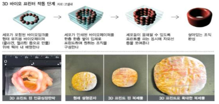 미국의 코넬 대학교 인공심장판막