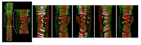 MicroCT 촬영 기법을 이용한 조직의 3차원적 영상 획득