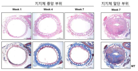 기관 지지체 부위별 H&E 염색(상단)과 Masson’s trichrome (MT) 염색 (하단) 이미지