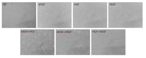 성장인자 종류에 따른 인간 간엽줄기세포의 형태학적 변화