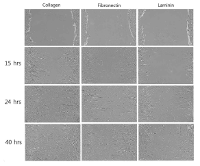 다양한 세포외기질이 도포된 배양접시에서의 지방유래 줄기세포의 이동성 확인