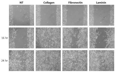다양한 세포외기질이 도포된 배양접시에서의 인간기도상피세포의 이동성 확인