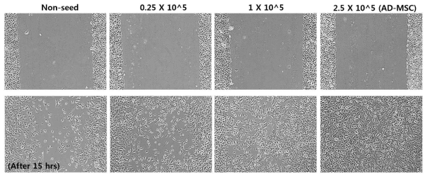 Transwell 내 AD-MSC 세포 농도에 따른 hBEC의 이동성 차이
