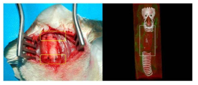 (좌) 외과적 수술 방법을 이용한 실험동물 체내 이식 사진. (우) MicroCT를 활용한 체내 기관지지체의 모습