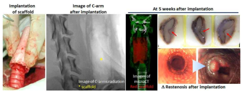 [첫번째 시도] 지지체 이식 수술 모습. 지지체 이식 후, C-arm X-ray을 통한 확인. 이식 5주 후, microCT를 통한 확인 및 1cm 간격으로 자른 기관의 단면 모습 및 내시경을 통해 확인된 기관 협착