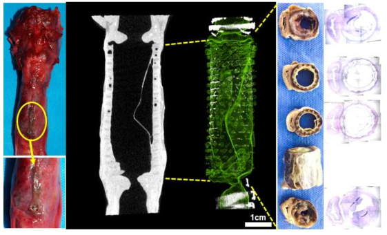 [다섯번째 시도-1] 기관 지지체 이식 5주 후, 적출된 지지체가 이식된 기관의 모습 (Yellow circle: 괴사된 조직). MicroCT를 이용한 기관의 개방성 평가 (3D 프린팅/나노섬유 복합체 도관에서 나노섬유 부분이 분리됨). 적출된 조직을 1cm 간격으로 잘라 조직병리학적으로 기관의 개방성 평가