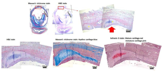 [다섯번째 시도-2] 이식되었던 기관 지지체 윗부분 (성대 쪽)의 조직병리학적 방법을 통한 신생연골 평가. hBM-MSC를 도포해준 지지체 외부의 조직에서 신생연골로 사료되는 부분을 두 곳 확인 함 (Yellow asterisks on H&E stained image: 상단 오른쪽). H&E,Masson’s trichrome, 그리고 Safranin O 염색을 한 후, 상단 오른쪽 붉은 화살표로 표시한 부분을 확대한 이미지들 (하단)