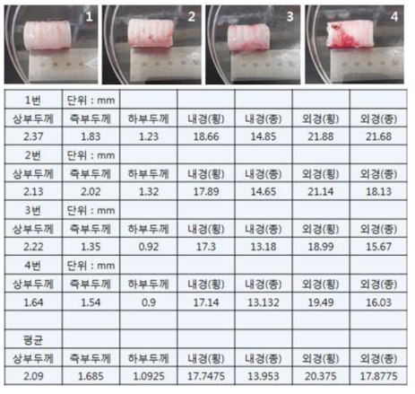 실제 동물 모델에서 추출된 기관지 및 크기 측정 결과