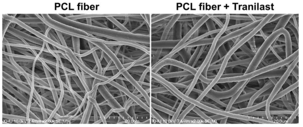 제작된 나노섬유 지지체의 전자주사현미경 사진