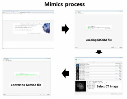 전용 소프트웨어를 이용한 DICOM file의 데이터선별 및 시각화 작업