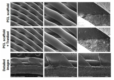 파이버 지지체 위에 3D 프린팅 후 전자주사현미경사진