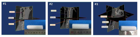 DICOM 이미지를 통해 측정한 기관 직경에 맞춰 제작된 기관 지지체들
