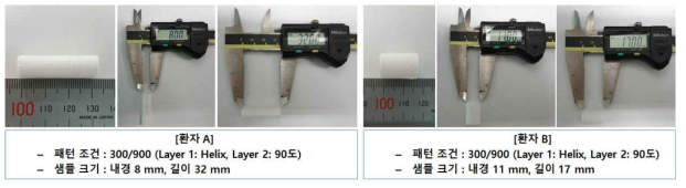 임상 환자의 DICOM data를 이용한 맞춤형 3D 기관 지지체 제작