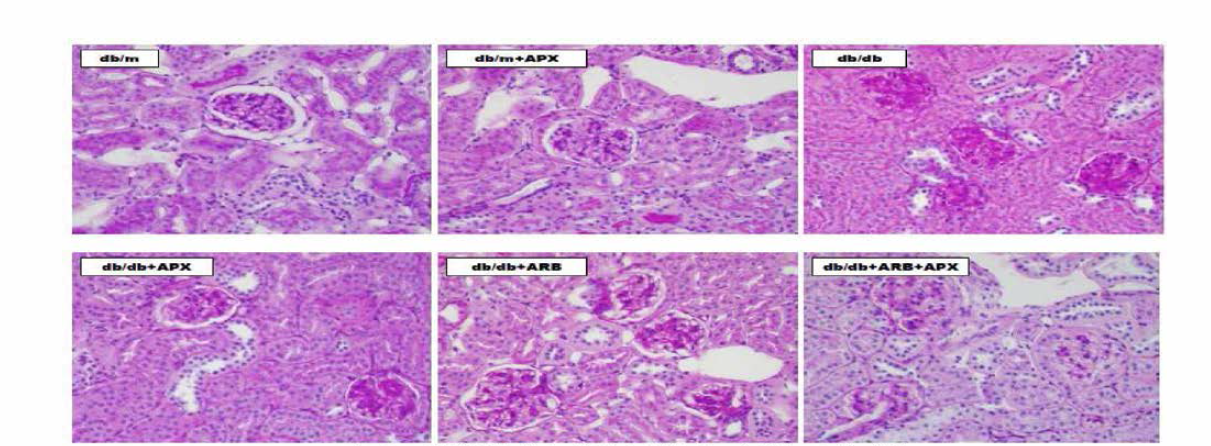 실험동물에서 치료 3개월 후 신장의 조직 변화