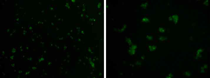 GFP발현을 통하여 transfection 결과 확인