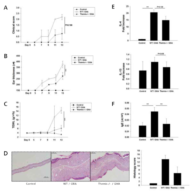 Oxazolone으로 아토피 피부염을 유도한 Themis Knock-out 마우스