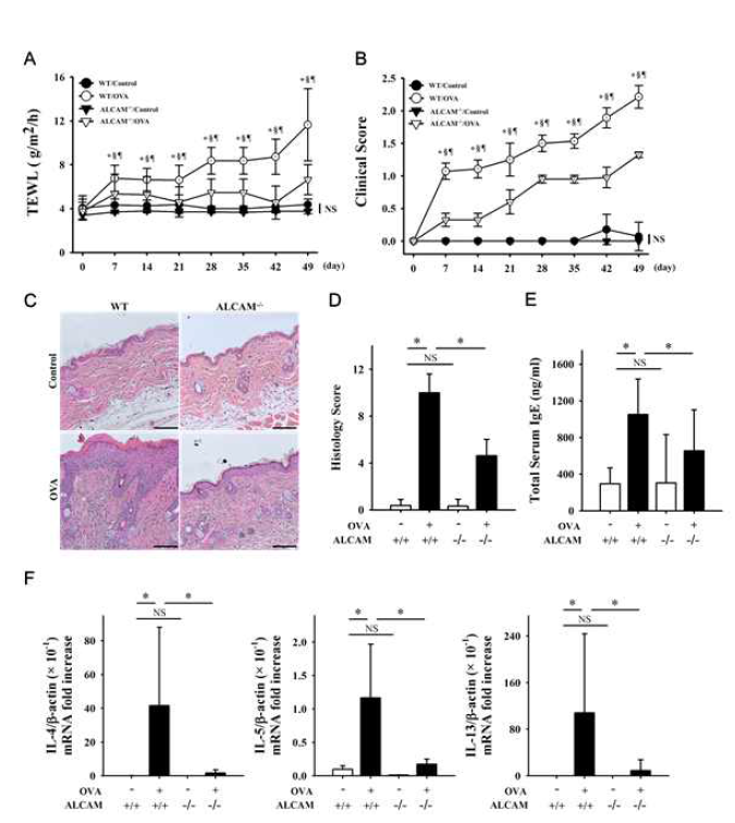 Ovalbumin으로 유도한 아토피 피부염 마우스 모델에서 면역반응 확인