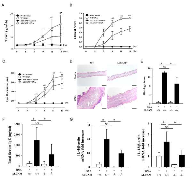 Oxazolone으로 유도한 아토피 피부염 마우스 모델에서 면역반응 확인