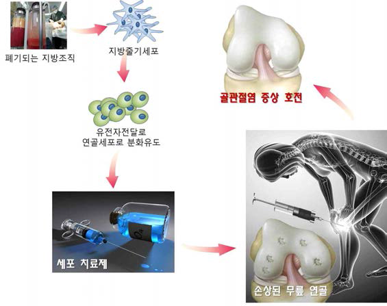 골관절염 증상 호전을 위한 세포 치료제 개발 (폐기되는 지방조직에서 추출된 지방줄기세포를 이용한 세포치료제)