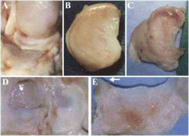 간엽줄기세포가 주입된 염소의 골관절염에서 연골 및 반월상 연골판의 재생 (Murphy et al 2003)