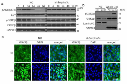 Serpina3C와 GSK3b의 연관성. (a) Serpina3C의 siRNA를 처리하면 phospho AKT가 지속적이고 증가되게 되며, 이로 인해 GSK3b도 인산화가 지속됨이 보임. (b) 인산화된 GSK3b는 세포질로 이동되기 때문에 핵에 존재할 수 없고, 그 결과 핵에 존재하는 GSK3b의 양이 줄어들게 됨. (c) 면역형광염색으로 GSK3b를 관찰하면, Serpina3C를 억제한 경우 GSK3b는 계속해서 세포질에 머물러 있음을 볼 수 있음