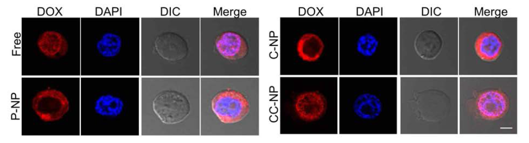 Localization of free DOX and DOX loaded P-NP, C-NP and CC-NP treated Jurkat T cells at pH5.5 condition. bPEI NPs treated for 1 hour and analysis using confocal microscope