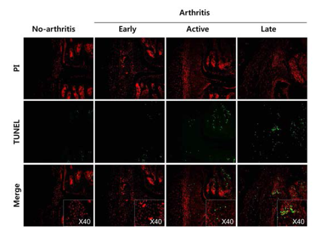 Stage dependent apoptosis detection in CIA mice by TUNEL staining. CIA mouse ankle tissue from no arthritis, early, active and late stage of arthritis were analysed by TUNEL staining. Apoptotic cells (green) at inflamed synovium. Magnification x200