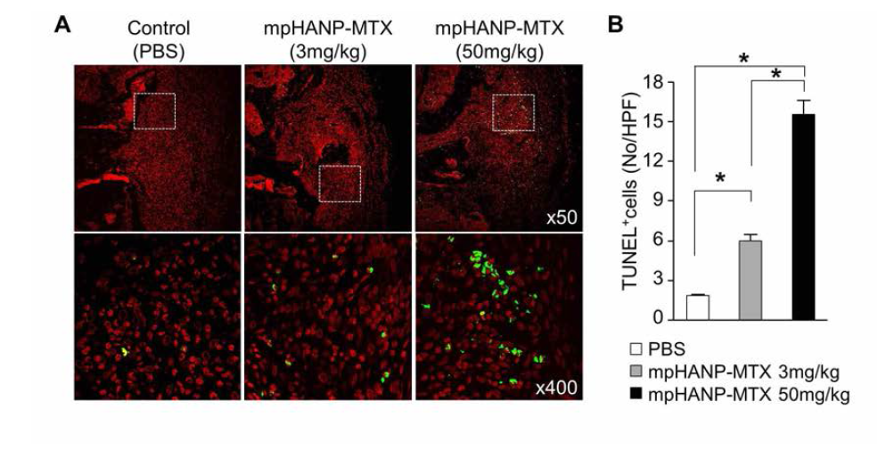 Apoptosis detection in CIA mice with MTX loaded mpHANPs by TUNEL staining. (A) Representative figures of CIA mouse ankle tissue treated with MTX loaded mpHANPs 3mg/kg, 50mg/kg. Apoptotic cells (green) at inflamed synovium. Magnification x50, x400. (B) Quantification of TUNEL positive cells in paws (n=3, * p<0.05)