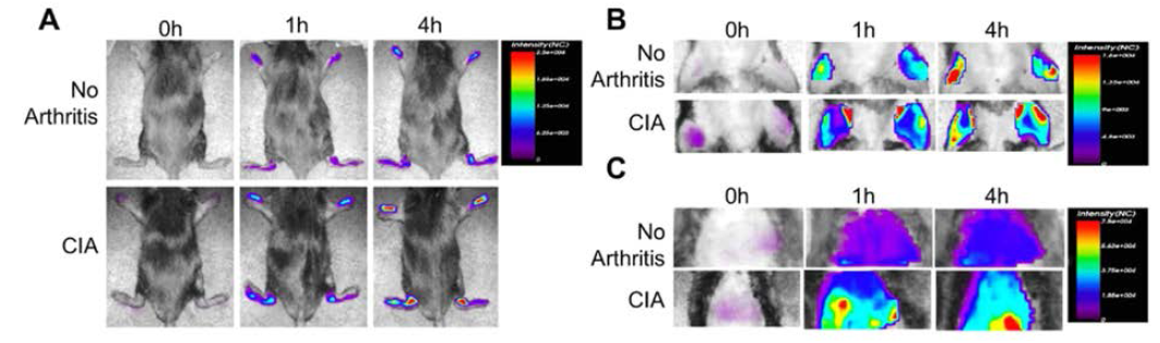 Accumulation of C-NPs in the inflamed joint and liver of normal and active CIA mice. NIRF images of paws, knee and liver after i.p. injection of Cy5.5 C-NPs (5mg/kg)