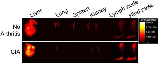 Ex vivo fluorescence images of organs of normal and CIA mice 4h post injection of Cy5.5 labeled C-NPs