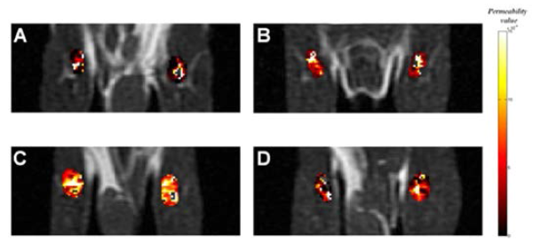 Representative vascular permeability-surface area product maps for (A) control, (B) early, (C) active, and (D) late stages in CIA model (n=5 mice in each group). (Magnetic Resonance in Medicine, in final revision)