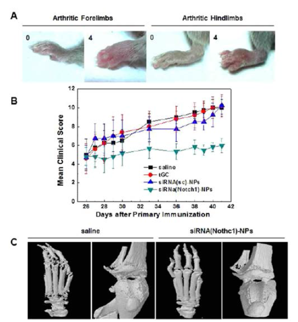 Disease progression monitoring for RA therapeutic effect in CIA model. (A) Standard images of limbs of CIA model. Mean clinical score measurements (B) and 3D reconstruction of inflamed limbs (B) of siRNA-NP treated CIA model (J control Release, 2015;216:140)