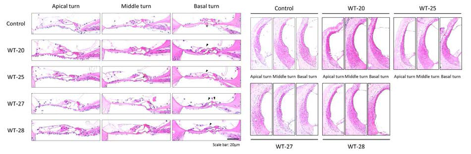 코르티기관과 lateral wall의 조직학적 변화양상을 비교 분석함