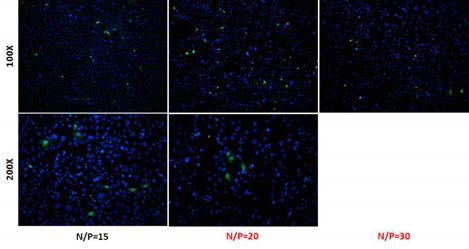 Branched Polyethylenimine를 이용하여 내이유래세포주에서 GPF의 발현을 검사하여 적절한 N/P비율로 20을 확인함