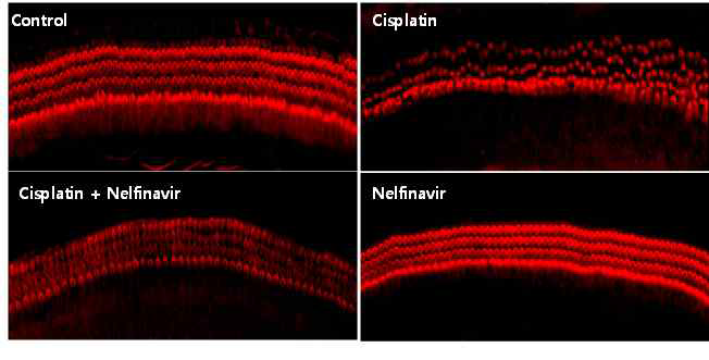 Cisplatin에 의한 유모세포 배열이상이 NFV에 의해 보호되는지에 대한 실험을 수행함