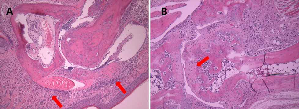 H&E staining of joint section. A. In joint section of mice sacrificed at week 21, inflamed synovium invading joint surface (arrow) are seen at early stage. B. In mice sacrificed at week 35, new bone formation (arrow) is seen at ㅓoint surface at late stage