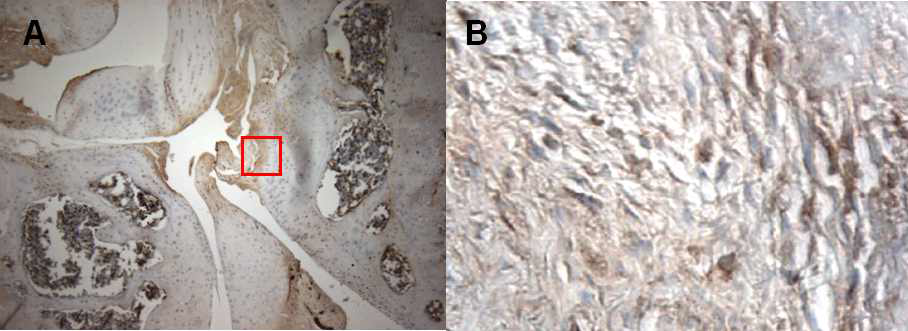 Immunohistochemistry for ATG staining in sacroiliac joint section. A. Dense LC3 staining is seen at inflammed tissues around sacroiliiac joint of animal model (magnification × 10). B. Immunoreactivity of LC3 is found in proliferated spindle-shaped fibroblast-like cells (magnification × 100)