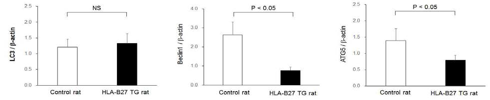 Western blot analysis for LC3, beclin1 and ATG5 levels in spinal tissues of animal model. LC3 level sid not show any significant difference between HLA-B27 transgenic rat and negative control rat. Beclin1 and ATG5 peptide productions were significantly decreased in HLA-B27 transgenic rats, compared to control rats