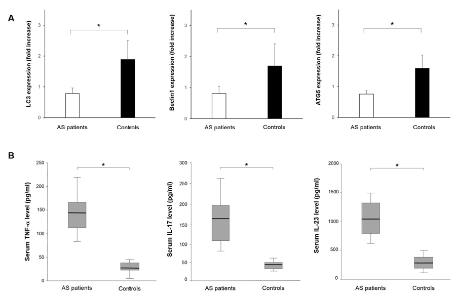 Autophagy-related gene expression levels in PBMCs and serum cytokine concentrations. A. LC3, beclin1, and ATG5 mRNA expression levels were significantly decreased in PBMCs of AS patients compared with those from controls. B. Serum concentrations of TNF-a, IL-17, and IL-23 were significantly higher in AS patients than in healthy controls. *p<0.05