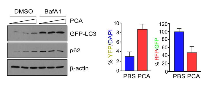녹색형광단백질로 표지된 LC3 플라스미드 (GFP-LC3)와 RFP-GFP-LC3를 이용하여 프로테좀 활성화에 따른 세포내 자가 포식소포의 존재를 형광현미경을 통해 관찰한 결과 autophgosom-lysosome fustion에서의 문제가 확인 되었음